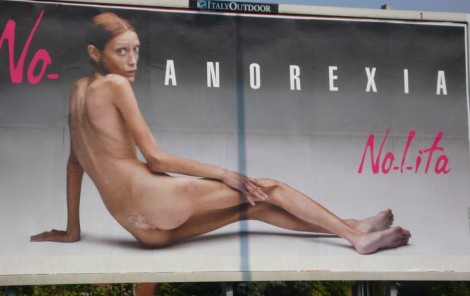 anorexic